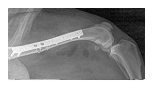 X-ray showing arm bone with metal plate.